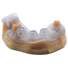 Матеріал (смола) для 3-D друку KeyGuide ® Матеріал (смола) для 3-D друку KeyGuide ®